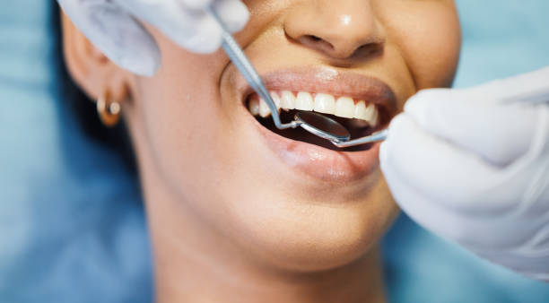 Best Emergency Dentist for Lost Fillings or Crowns in Sprague, WV