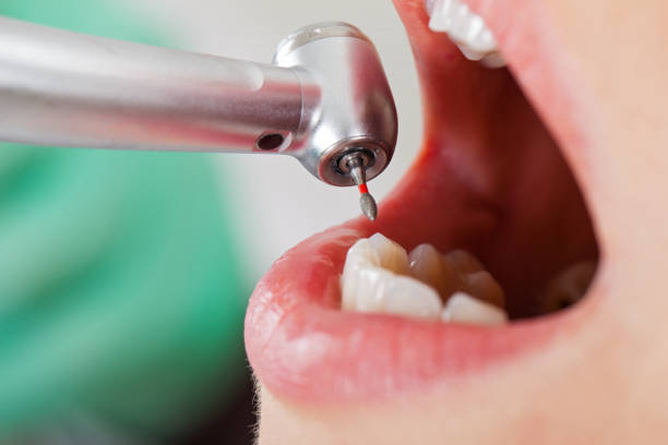 , WV Emergency Dentist Company